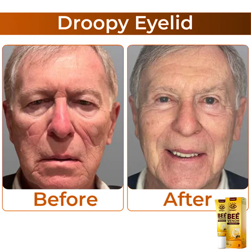 COLLAGEN+ BEE VENOM WAKE UP EYE CREAM (PACK OF 2)